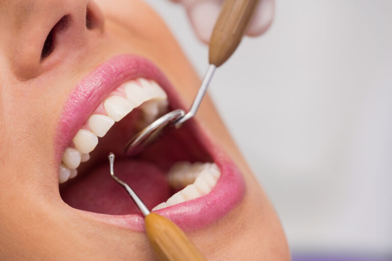 close up of dentist examining female patient teeth